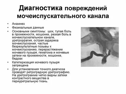Кровотечения мочеиспускания