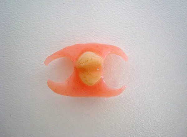 Съемный протез зуба бабочка. Микропротез бабочка на 1. Микропротез бабочка/ иммедиат-протез. Микропротез зуба бабочка.