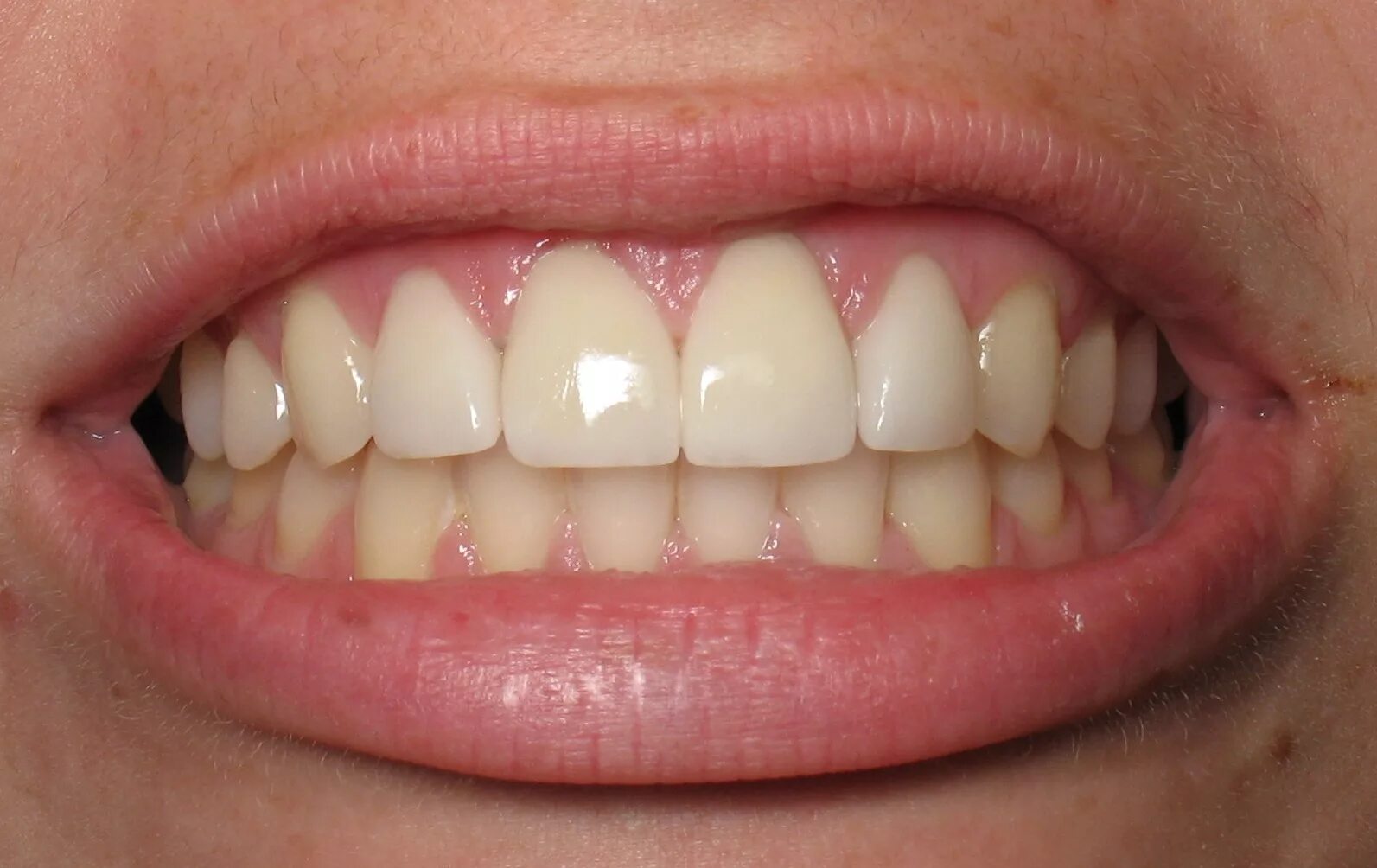 Зубы человека. Красивая форма зубов.