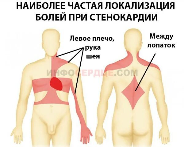 Жжет левой стороны. Локализация боли в легких. Боли в области сердца. Локализация стенокардии.