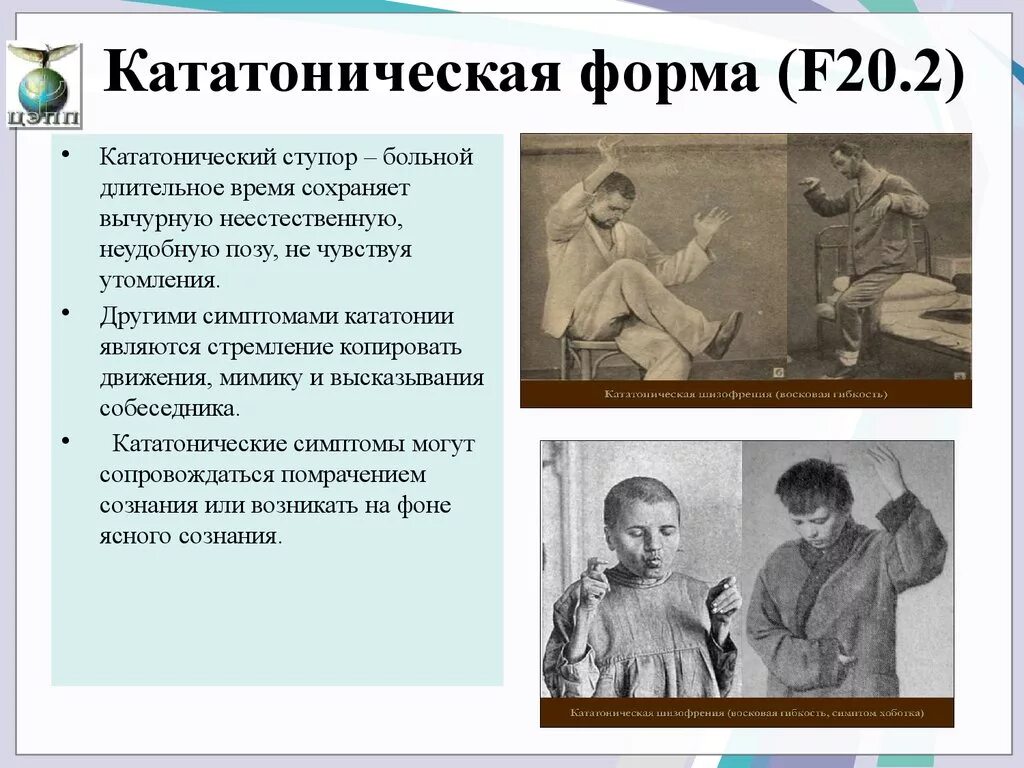 Кататоническое состояние. Кататоническая форма шизофрении. Кататонический ступор симптомы. Шизофрения кататоническая f. Кататоническая форма шизофрении симптомы.