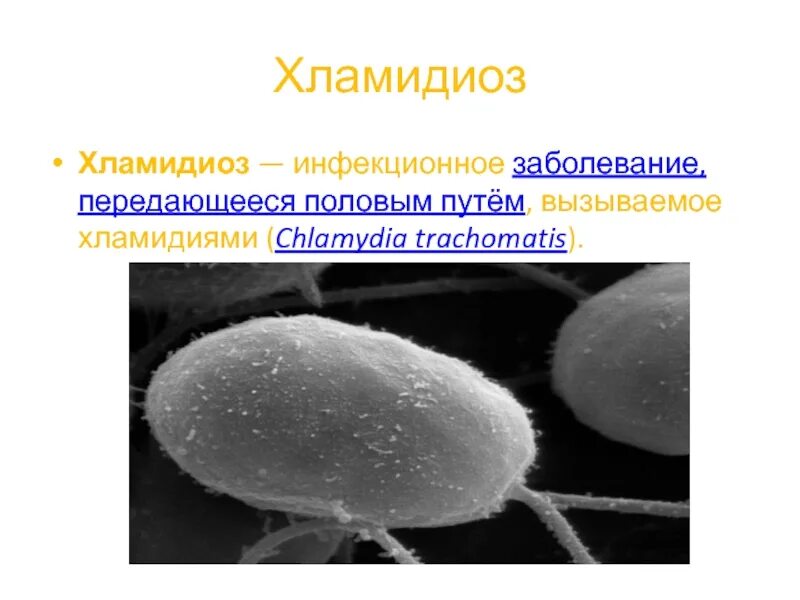 Хламидии как выглядят. Хламидиоз половых путей.