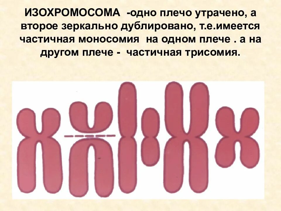 Изохромосомы. Изохромосома хромосома генетика. Дицентрическая хромосома болезнь. Образование изохромосом. Кольцевая хромосома 1