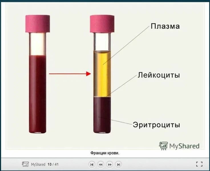 Разделенная кровью. Разделенная кровью. Разделенная кровью. Кровь в пробирке после центрифугирования. Разделенная кровью.