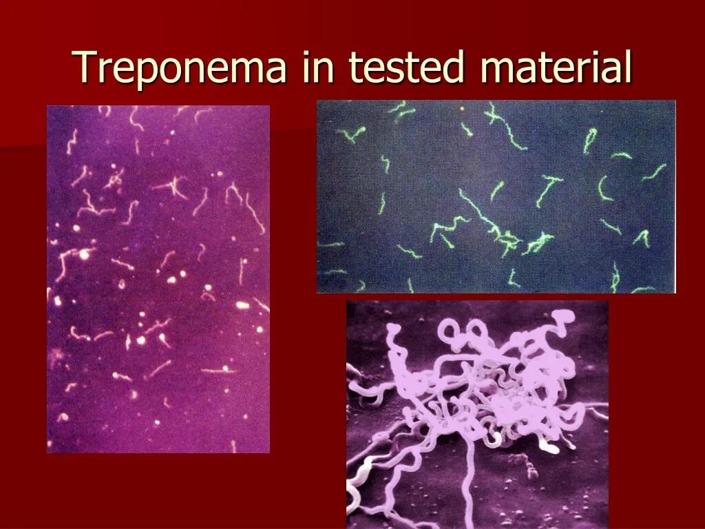 Бледная трепонема treponema pallidum. Бледная трепонема микроскоп. Трепонема паллидум возбудитель. Бледная спирохета микробиология.