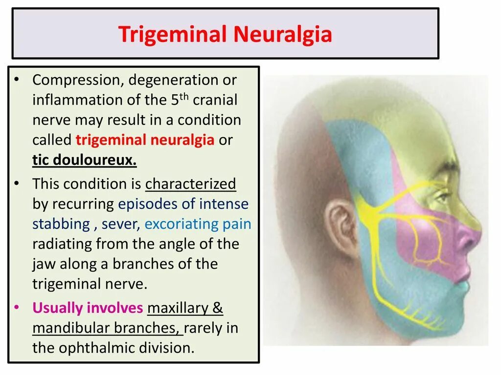 Neuralgia латынь. Trigeminal neuralgia. объяснить термин neuralgia.