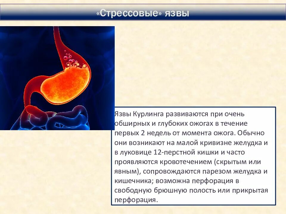 Соки при язве двенадцатиперстной. Труднорубцующиеся язвы желудка. Стрессовые гастродуоденальные язвы. Стрессовые язвы Курлинга.