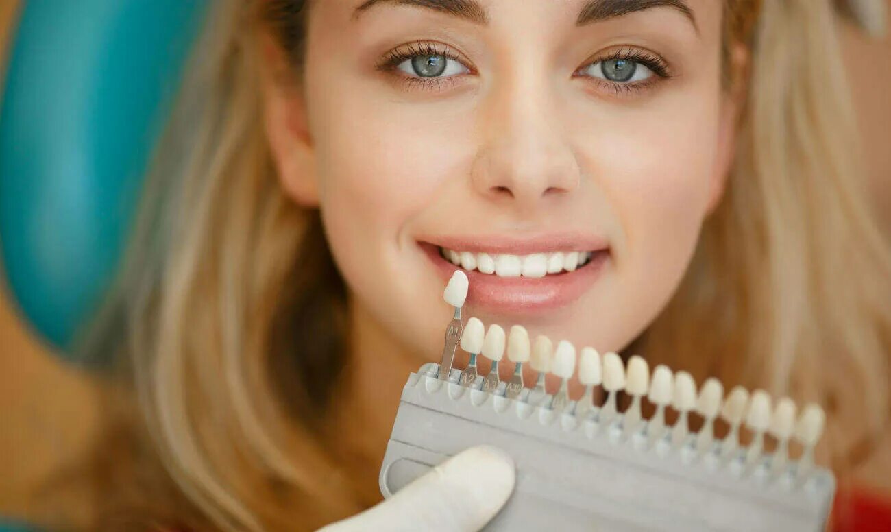 красивые зубы. естественный цвет зубов. отбеливание зубов а3 а1. улыбка цвета 1. самые белые зубы.