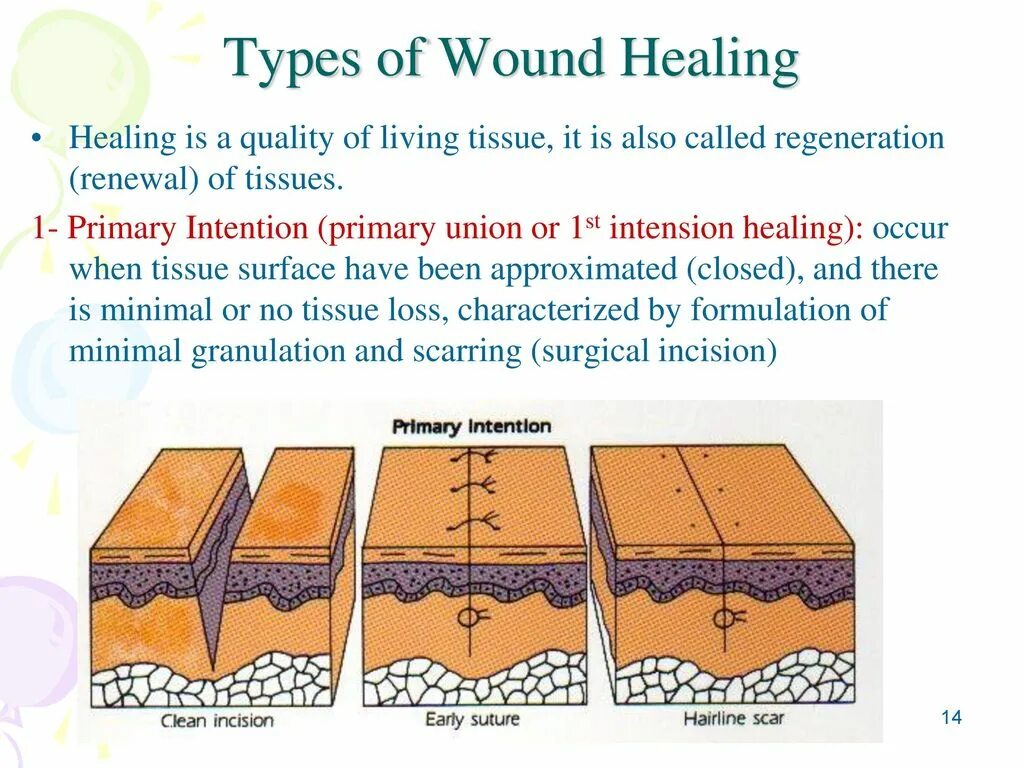 Types of wound. Types of wound