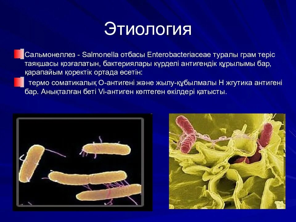 Salmonella этиология. Сальмонеллез этиология. Сальмонеллез возбудитель заболевания микробиология. Сальмонеллез этиология эпидемиология. Источник инфекции при сальмонеллезе