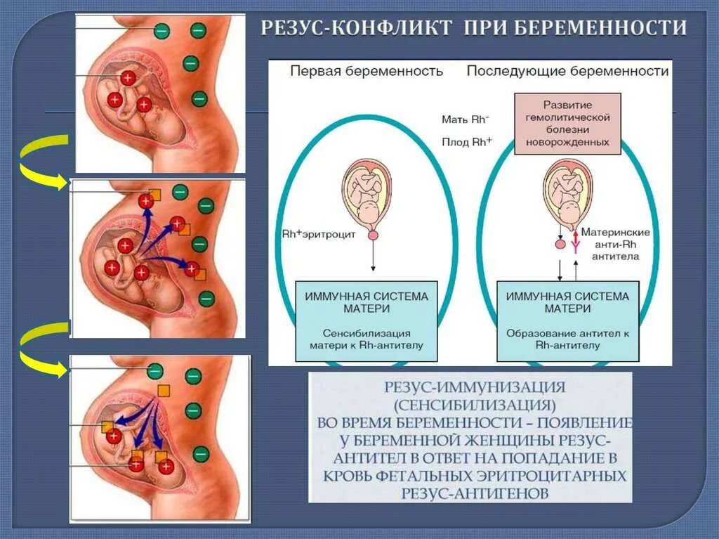 Риски при отрицательном резусе