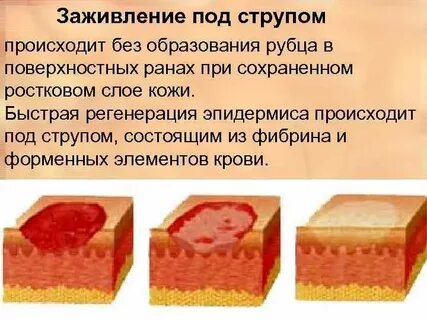 Плохо заживает кожа причины