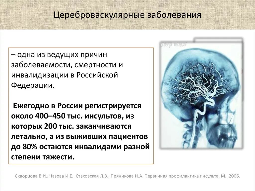 Поражение головного мозга диагноз. Цереброваскулярные болезни сосудов головного мозга. Цереброваскулярная недостаточность головного мозга. Церебрально васкулярная болезнь. Симптомы цереброваскулярной болезни.