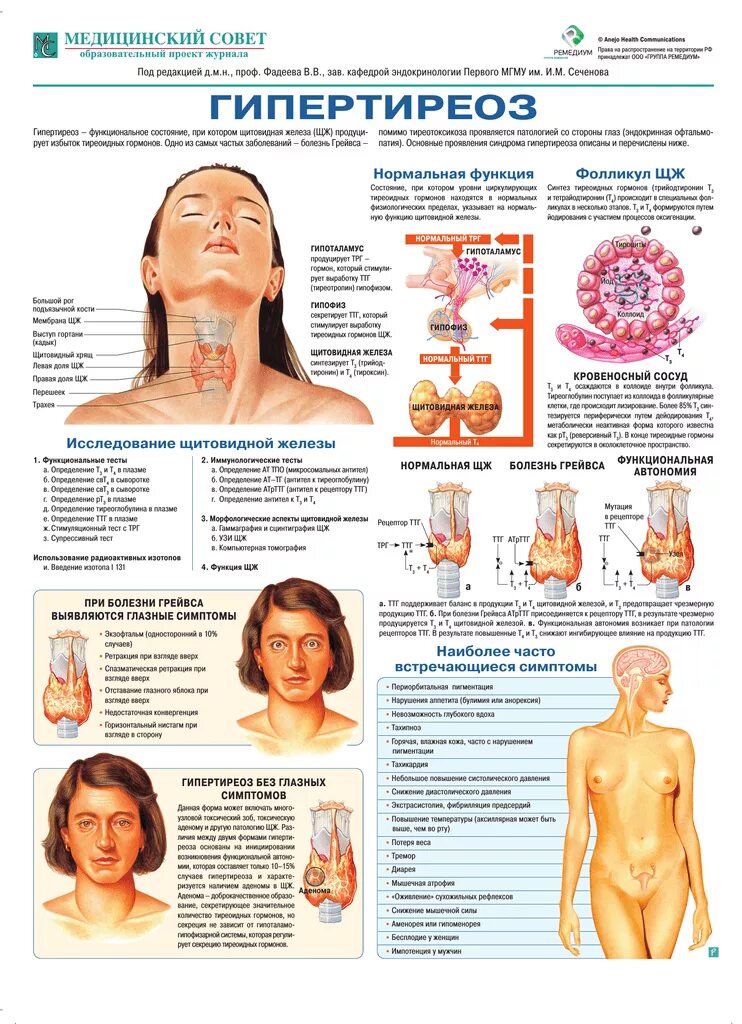 Гипертиреоз dr md ru. Гипертиреоз щитовидной железы. Тиреотоксикоз гиперфункция щитовидной железы. Гиперфункция щитовидной железы (гипертиреоз). Признаки гиперфункции щитовидной железы.