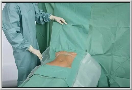 После лапароскопии носят бандаж. Комплект белья хирургического стерильный для лапаротомии. Стерильное белье в операционной. Операционное хирургическое белье. Обработка кожи операционного поля.