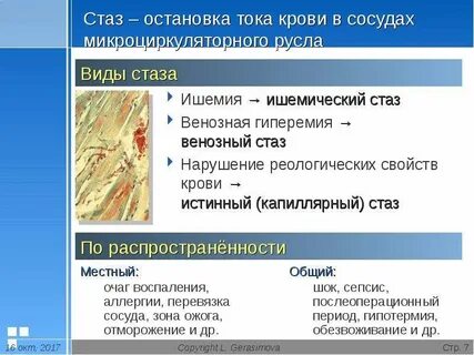 Нарушения реологических свойств