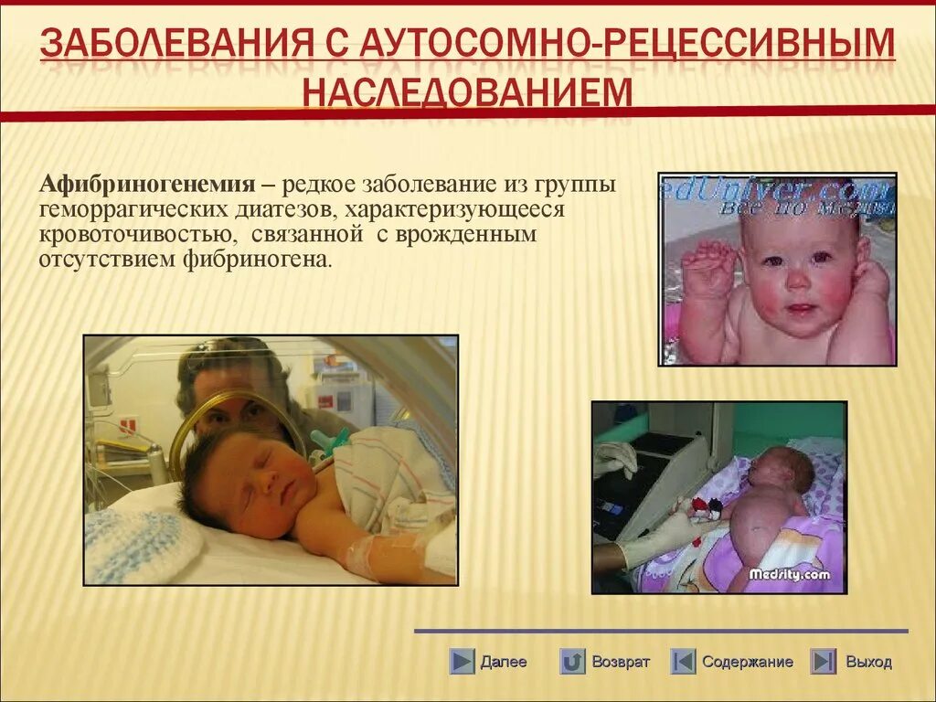 Аутосомно рецессивные заболевания. Наследственные заболевания аутосомно-рецессивные. редкие рецессивные заболевания. аутосомно рецессивные генные болезни.