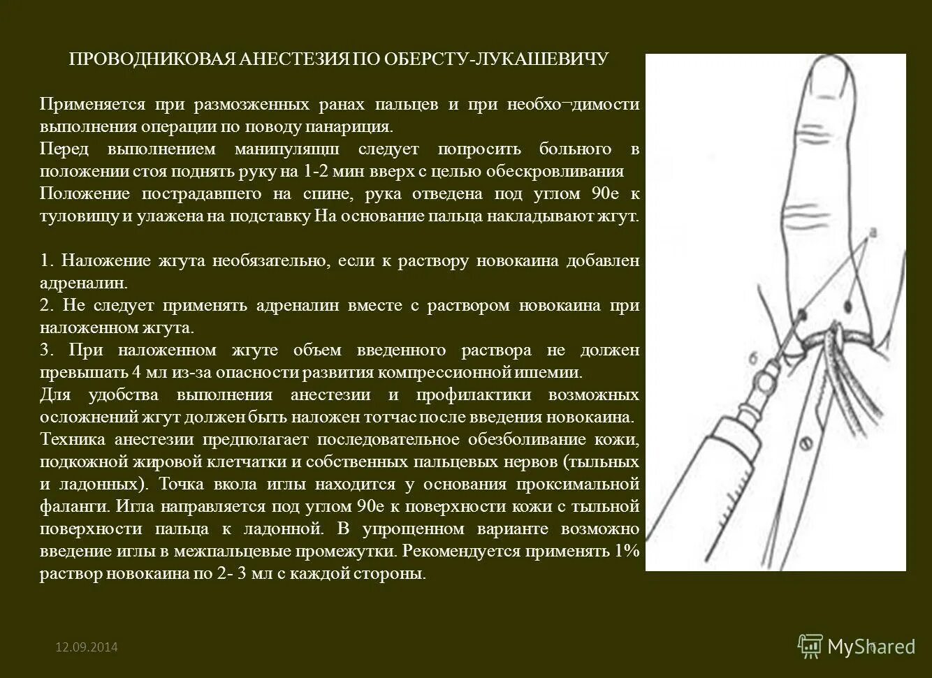 Анестезия по Лукашевичу-Оберсту. Новокаина по Лукашевичу. Анестезия по Лукашевичу-Оберсту пальца ноги. Как вводить лидокаин палец на руке.