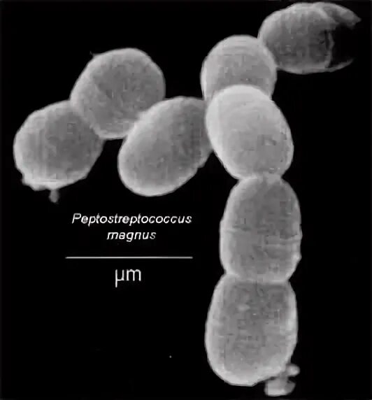 Peptostreptococcus. Пептострептококки микробиология. Анаэробные пептострептококки. Пептококки и пептострептококки. Пептострептококки морфология.