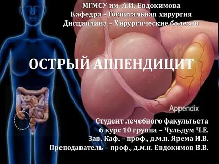 Аппендицит хирургические болезни