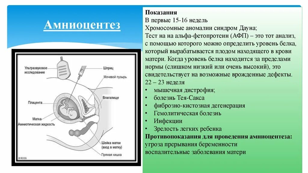 Плод тест 1. Пренатальная диагностика амниоцентез. Методы пренатальной диагностики амниоцентез. Исследование околоплодных вод амниоцентез. Инвазивные методы амниоцентез материал.