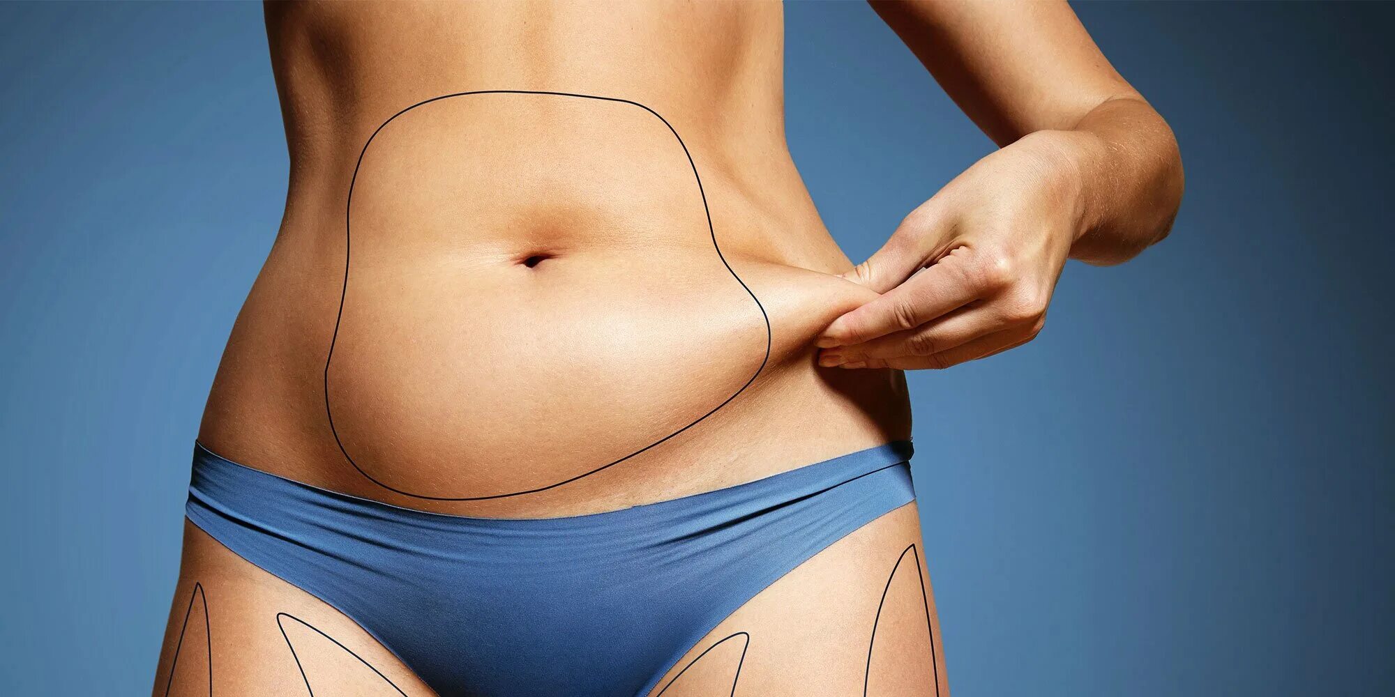 Живот вид сбоку женщины. Пушковые волосы над верхней губой. Почему у женщины растут лет. Полоска волос на животе у женщин. Волосатый живот у женщин.