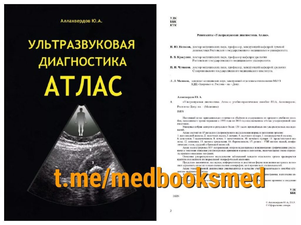 Аллахвердов атлас УЗИ. Ультразвуковая диагностика атлас Аллахвердов. Ультразвуковая диагностика книги