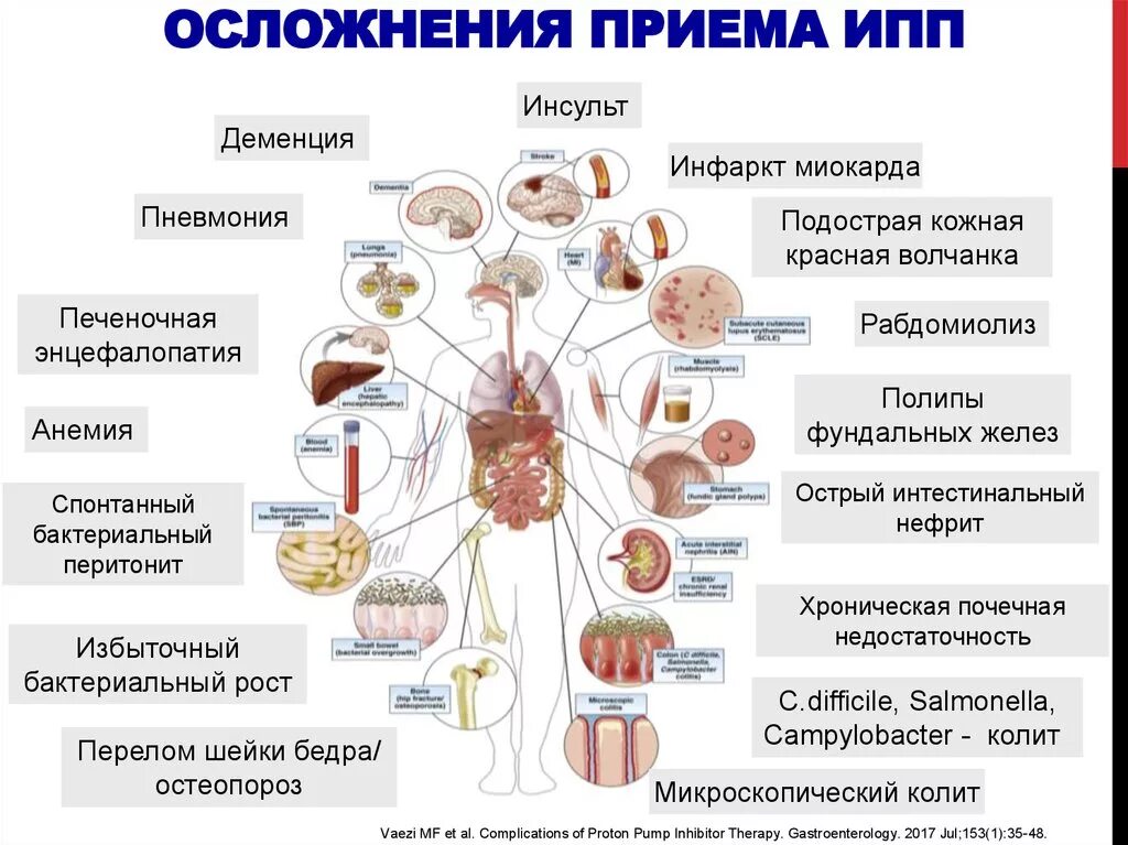 ИПП побочка. Инфекции передающиеся половым путем осложнения. Побочные действия ингибиторов протонной помпы. Осложнения деменции.