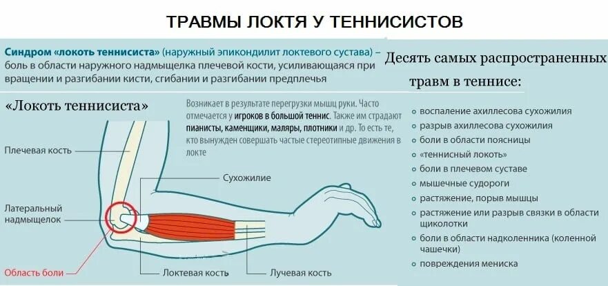 Признаки разрыва мышц