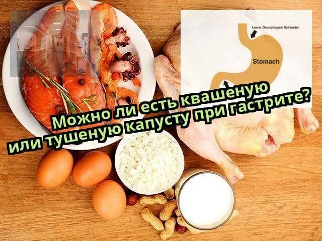 Можно ли капусту при язве желудка. Квашеная капуста гастрит. Капуста при гастрите. Квашеная капуста при заболевании ЖКТ. Квашеная капуста при заболеваниях желудка и кишечника.