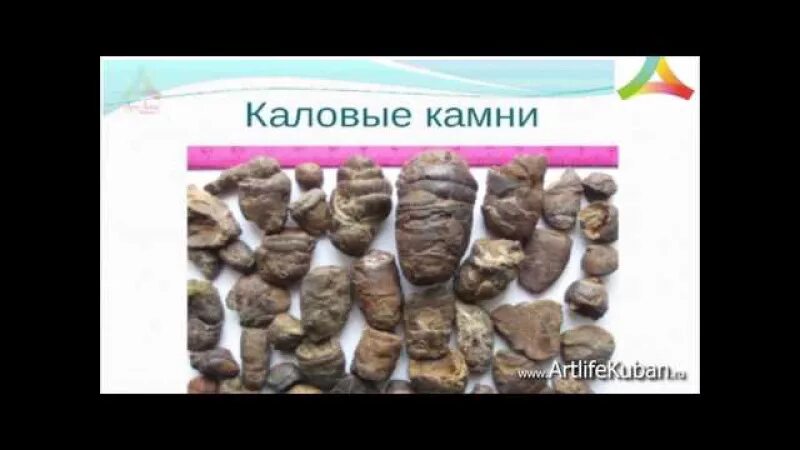 Как почистить кишечник от каловых. Как почистить кишечник от каловых