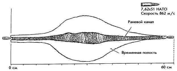 Раневая баллистика и зоны поражения тканей. Раневая полость и раневой канал. Раневой канал пули 7. Пульсирующая полость. Временная пульсирующая полость.