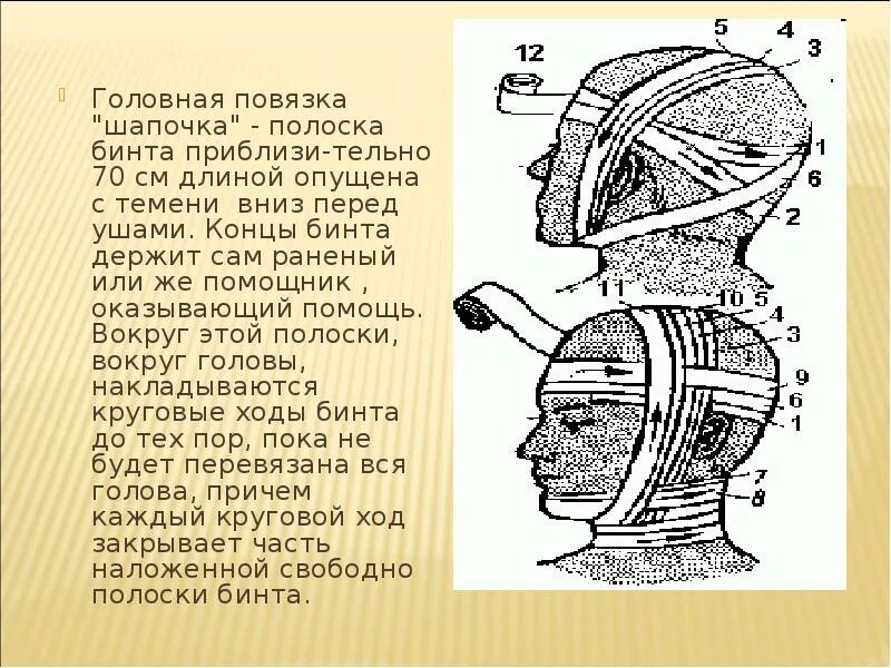 Повязка гиппократа техника наложения. Чепец и шапочка Гиппократа. Головная повязка шапочка. Головная шапочка перевязка. Шапочка Гиппократа повязка.