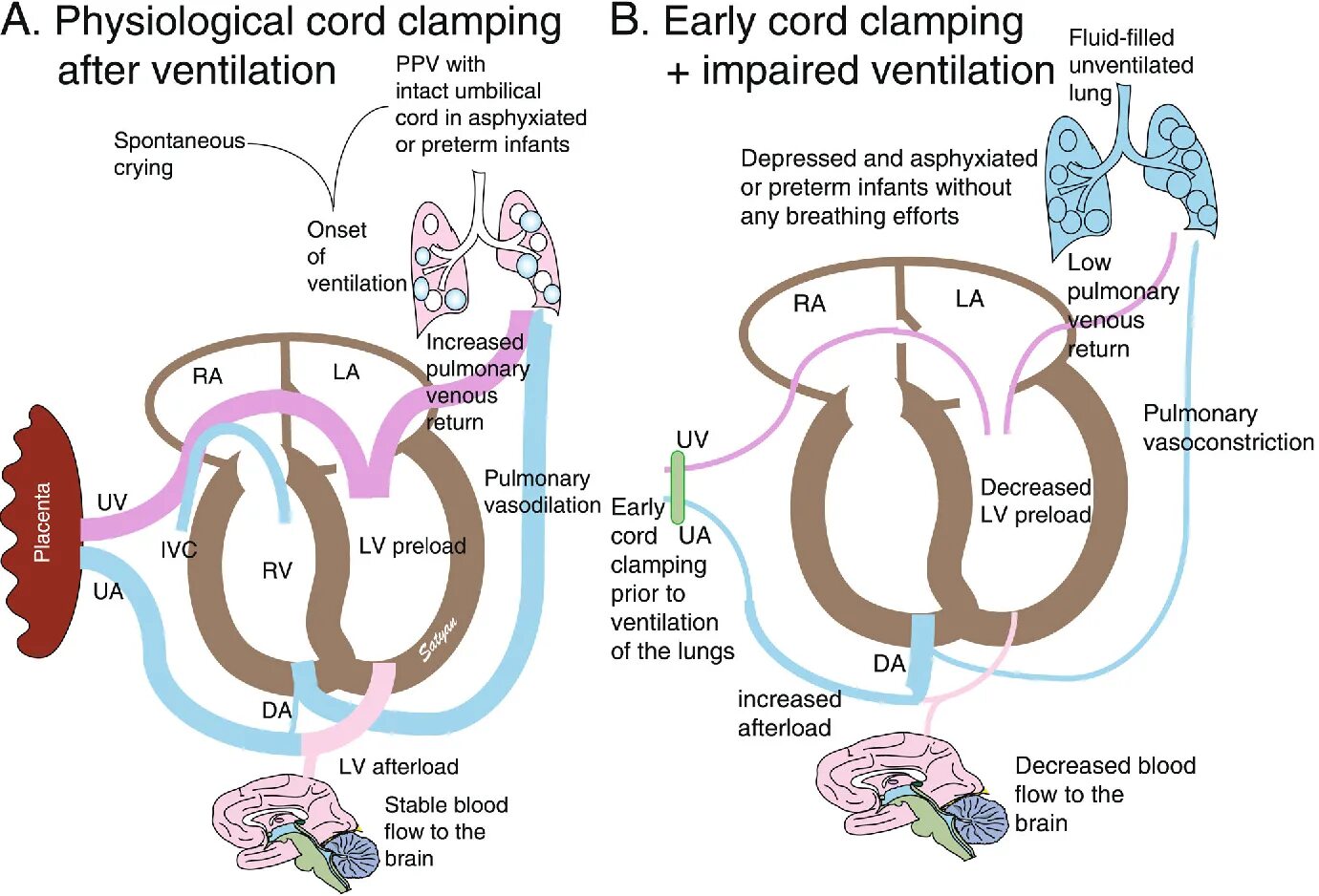 Neonatal Physiology. Neonatal Resuscitation program. Neonatal Physiology Pot.