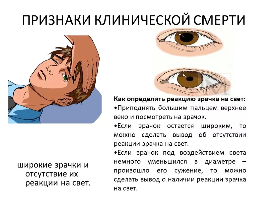 Расширяет зрачки уменьшает частоту сердечных. Реакция зрачков на свет при клинической смерти. реакция зрачков на свет при смерти. зрачки при клинической смерти. клиническаяс смерть зрачки.
