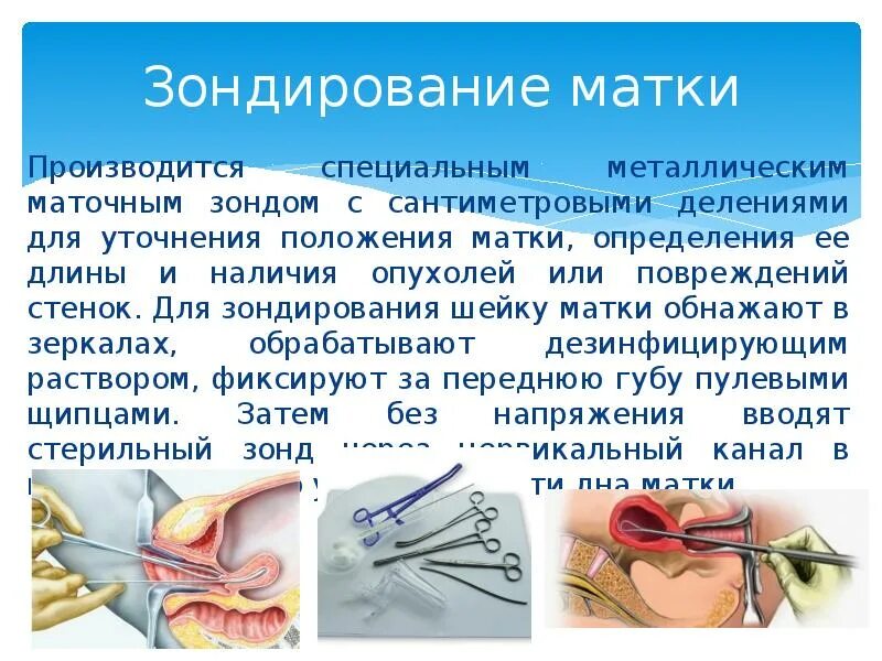 Зондирование матки метод исследования. Зондирование полости матки показания. Инструментарий для зондирования полости матки. Зондирование полости матки инструменты.