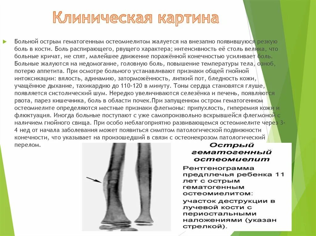 Остеомиелит у детей симптомы. Хронический остеомиелит большеберцовой кости кт. Негнойному остеомиелит. Гематогенный остеомиелит плечевой кости рентген. Хронический гематогенный остеомиелит бедренной кости.