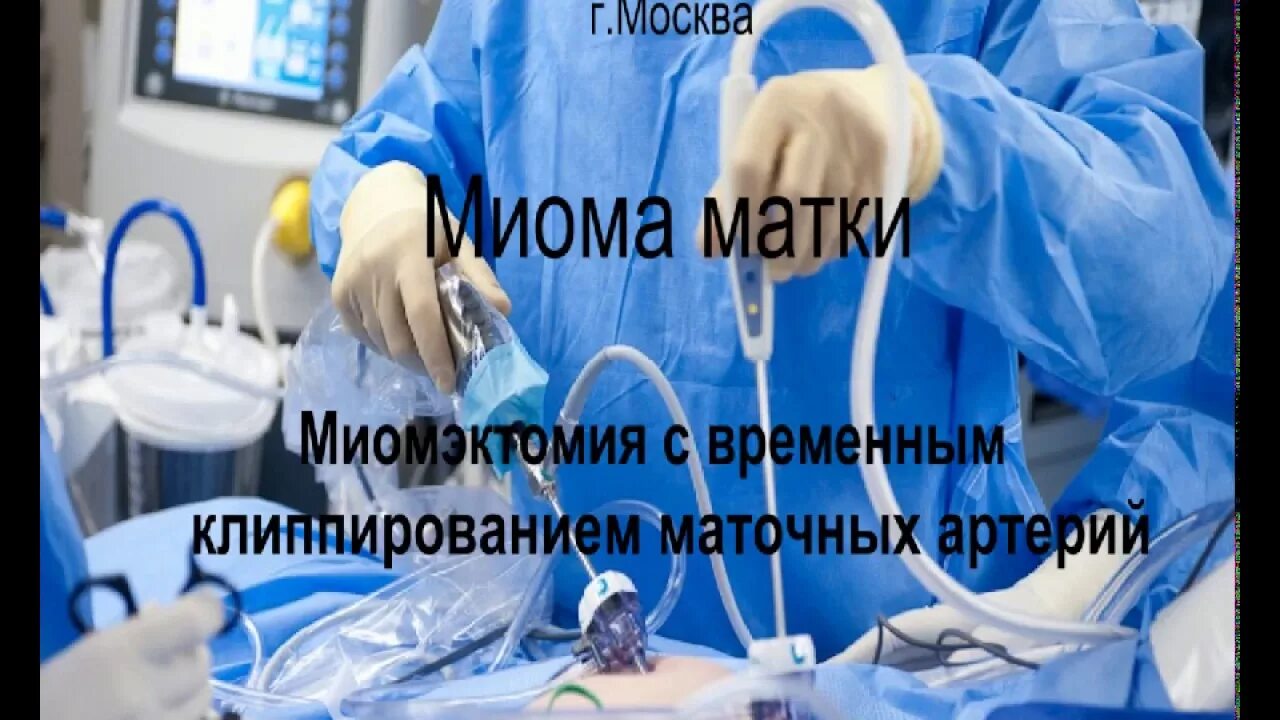 Лапароскопия матки отзывы. Операция по удалению миомы матки. Лапароскопия миомы матки.