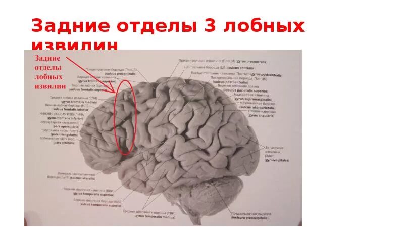 Задний отдел нижней лобной извилины. Задний отдел средней лобной извилины. Задний отдел лобной доли. Задний отдел верхней лобной извилины.