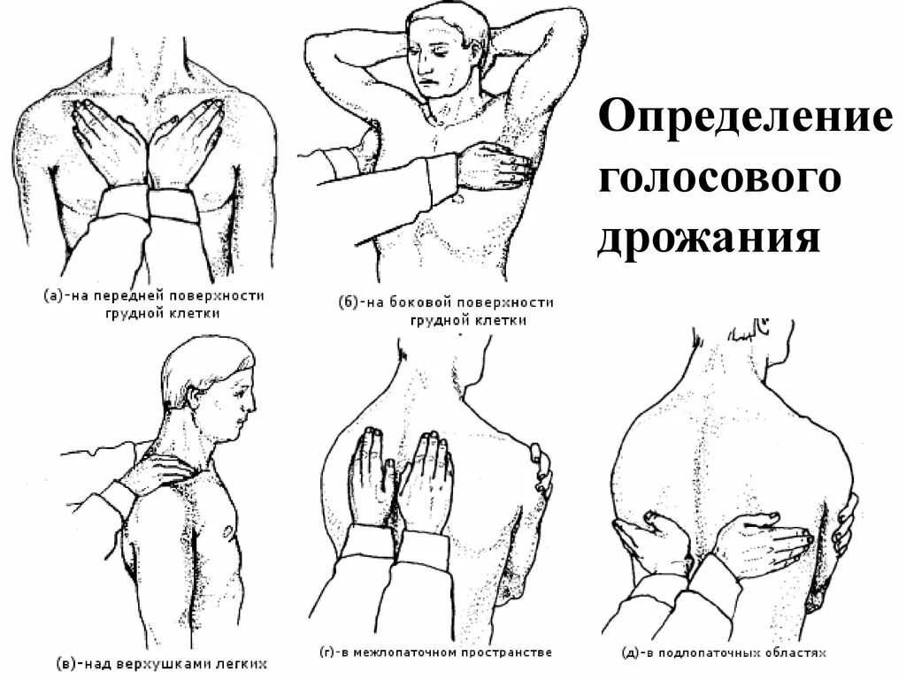 Методика определения голосового дрожания. Пальпация грудной клетки пропедевтика алгоритм. Пальпация грудной клетки голосовое дрожание. Голосовое дрожание точки.