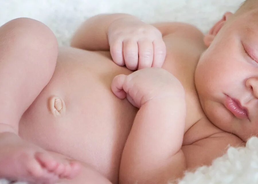 Пук новорожденных. Пупочная грыжа у новорожденных. Омфалит новорожденных омфалит.