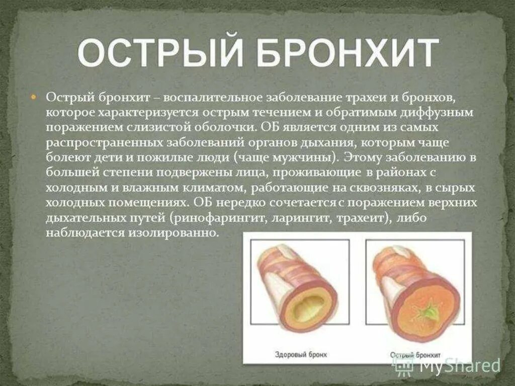 Бронхит противопоказания. Бронхит и острый бронхит. Острый инфекционный бронхит. При остром бронхите поражаются бронхи.