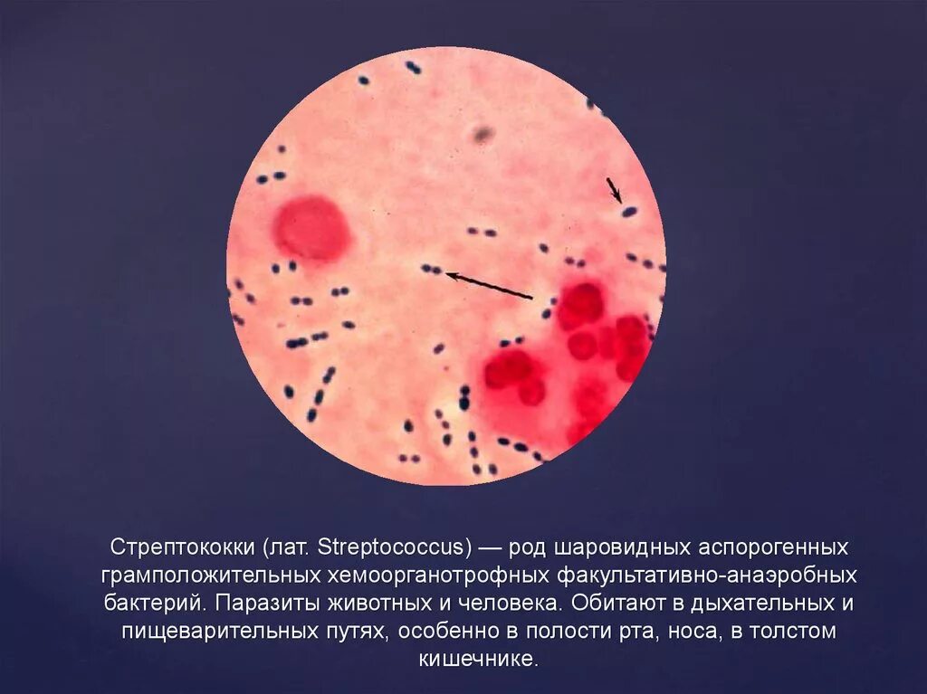 Род стрептококки. Факультативные и облигатные анаэробы. Факультативно анаэробные бактерии. Стрептококк грамм положительный. Грамотрицательные менингококки.