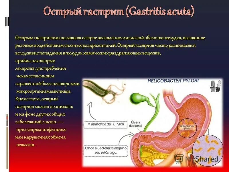 Формы острого гастрита. Острая ишемия органов пищеварения вызвана. Заболевания желудочно-кишечного тракта доклад. Гастрит раздражитель химические вещества. ГАСТРОЭНТЕРОПРОТЕКТОР на страже ЖКТ.