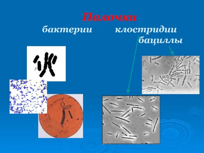 Микроорганизмы образующие споры. Палочковидными (бациллы, клостридии). Палочковидные бактерии бациллы. Клостридии форма бактерии. Форма клостридии и бациллы.