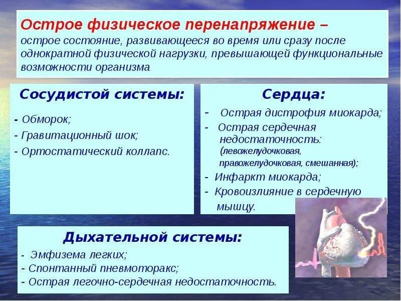 Физическая перегрузка какой фактор