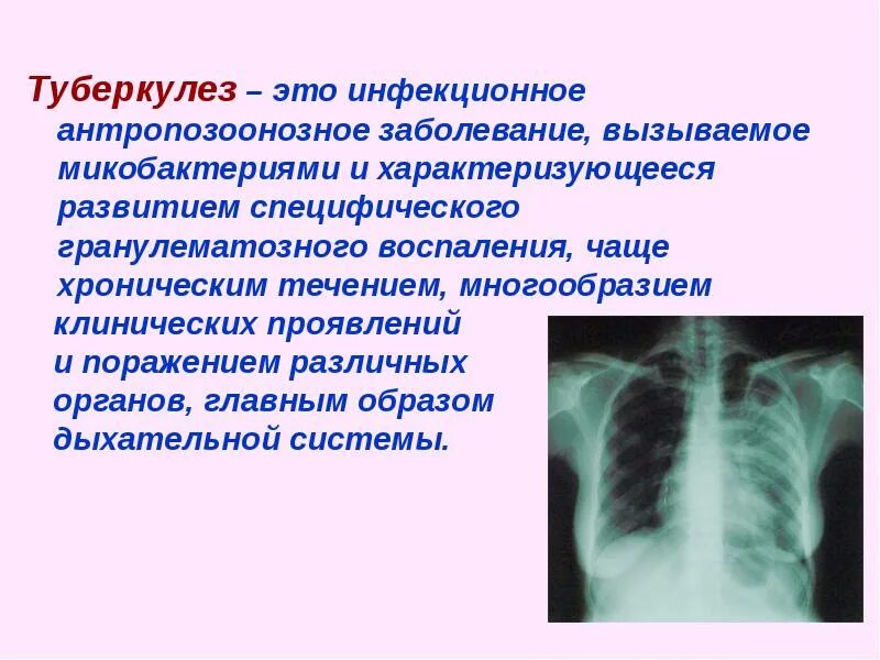 К каким заболеваниям относится туберкулез. Туберкулез поражение легких. Туберкулез заболевание кратко.