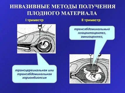 Инвазивная диагностическая процедура