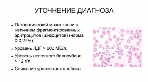 Шизоциты