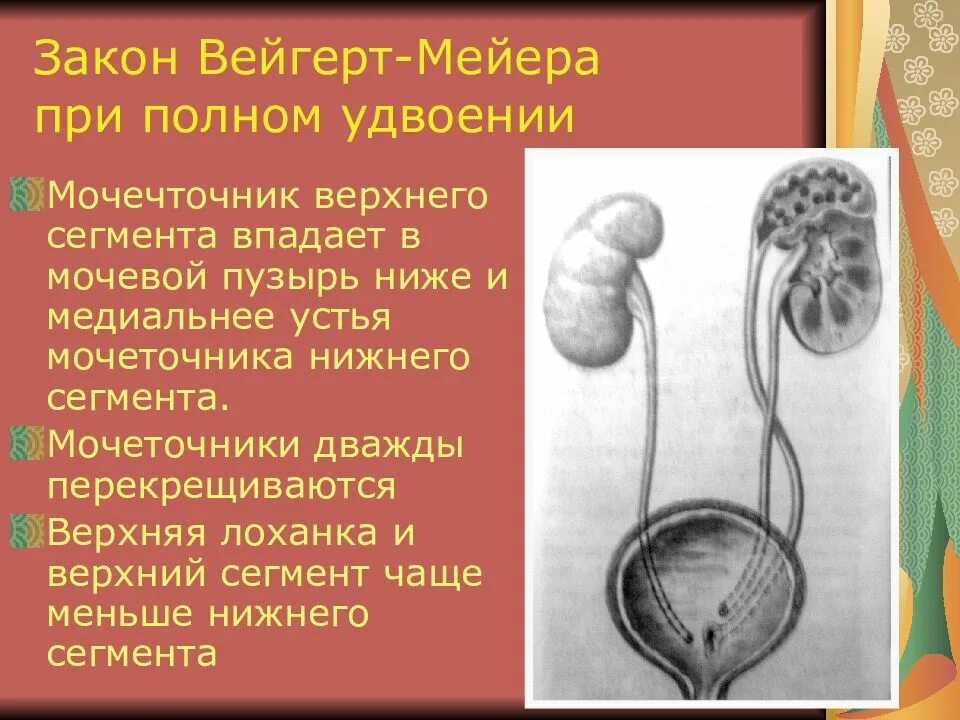 Удвоение мочеточника. Закон Вейгерта Мейера. Полное удвоение мочеточника. Неполное удвоение мочеточника. Удвоение почек и мочеточников это.